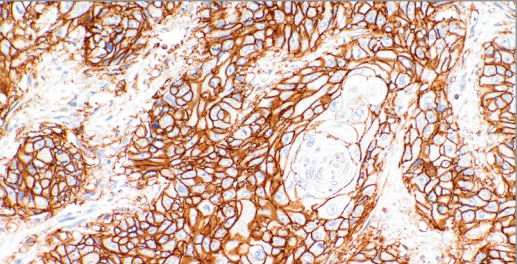 CD44 Rabbit Monoclonal Antibody(ARM950)
