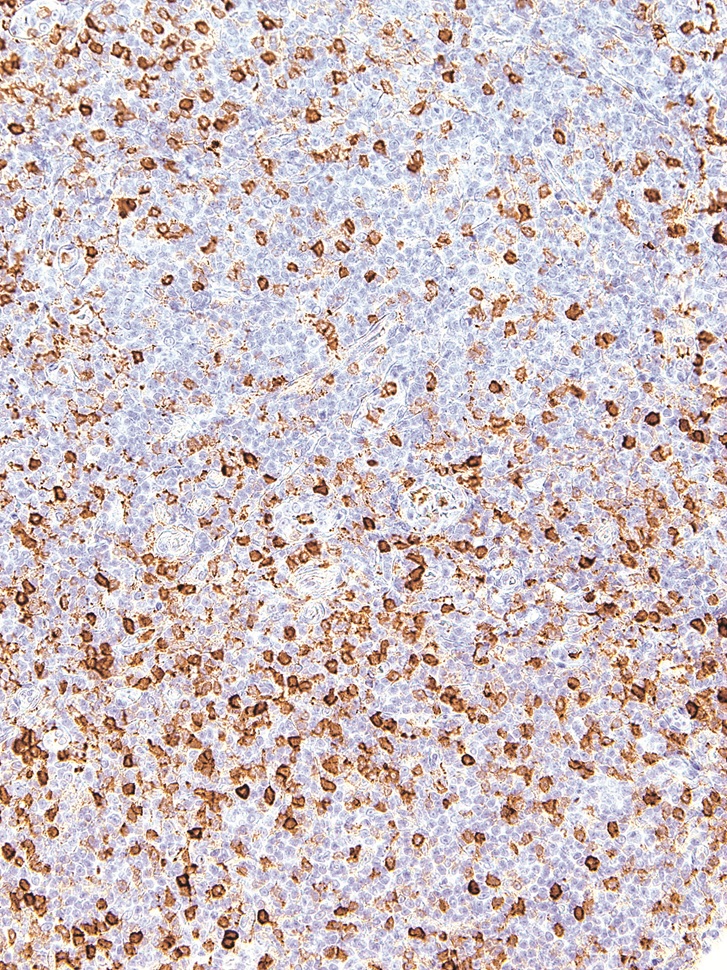 Annexin A1 Mouse Monoclonal Antibody(ARM924)