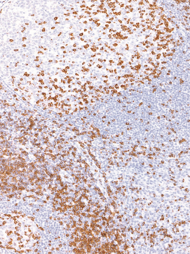 CD2 Rabbit Monoclonal Antibody(ARM941)