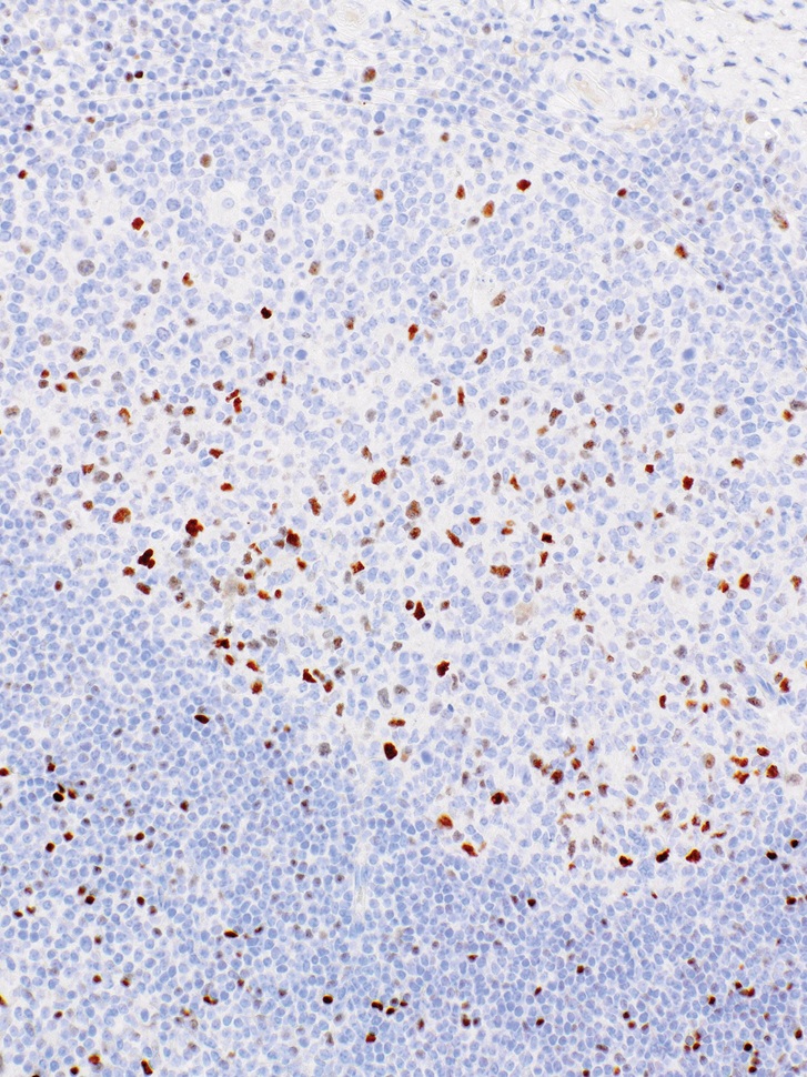 c-Myc Rabbit Monoclonal Antibody(ARM968)