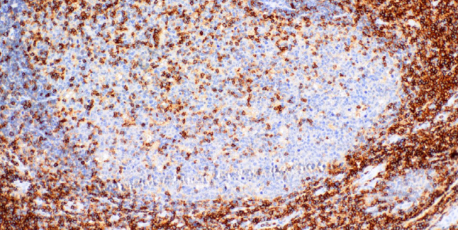 CD43 Mouse Monoclonal Antibody(ARM949)