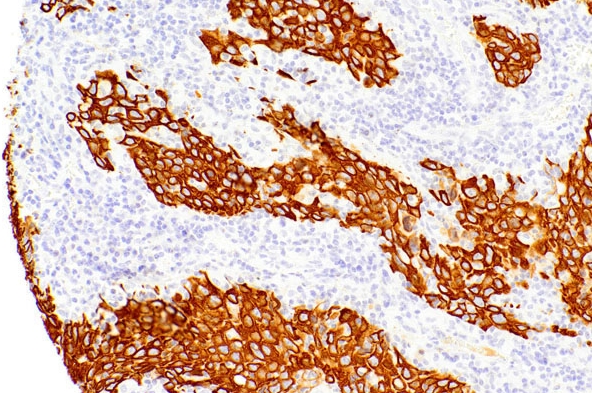 CK34Beta E Mouse Monoclonal Antibody(ARM913)