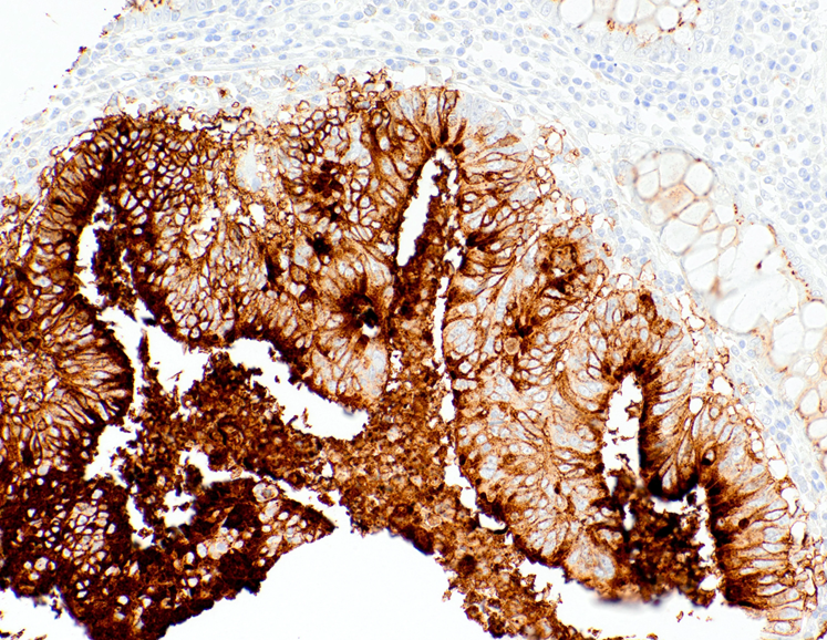 CA19-9 Mouse Monoclonal Antibody(ARM932)