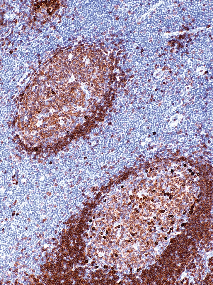 CD79a Rabbit Monoclonal Antibody(ARM960)