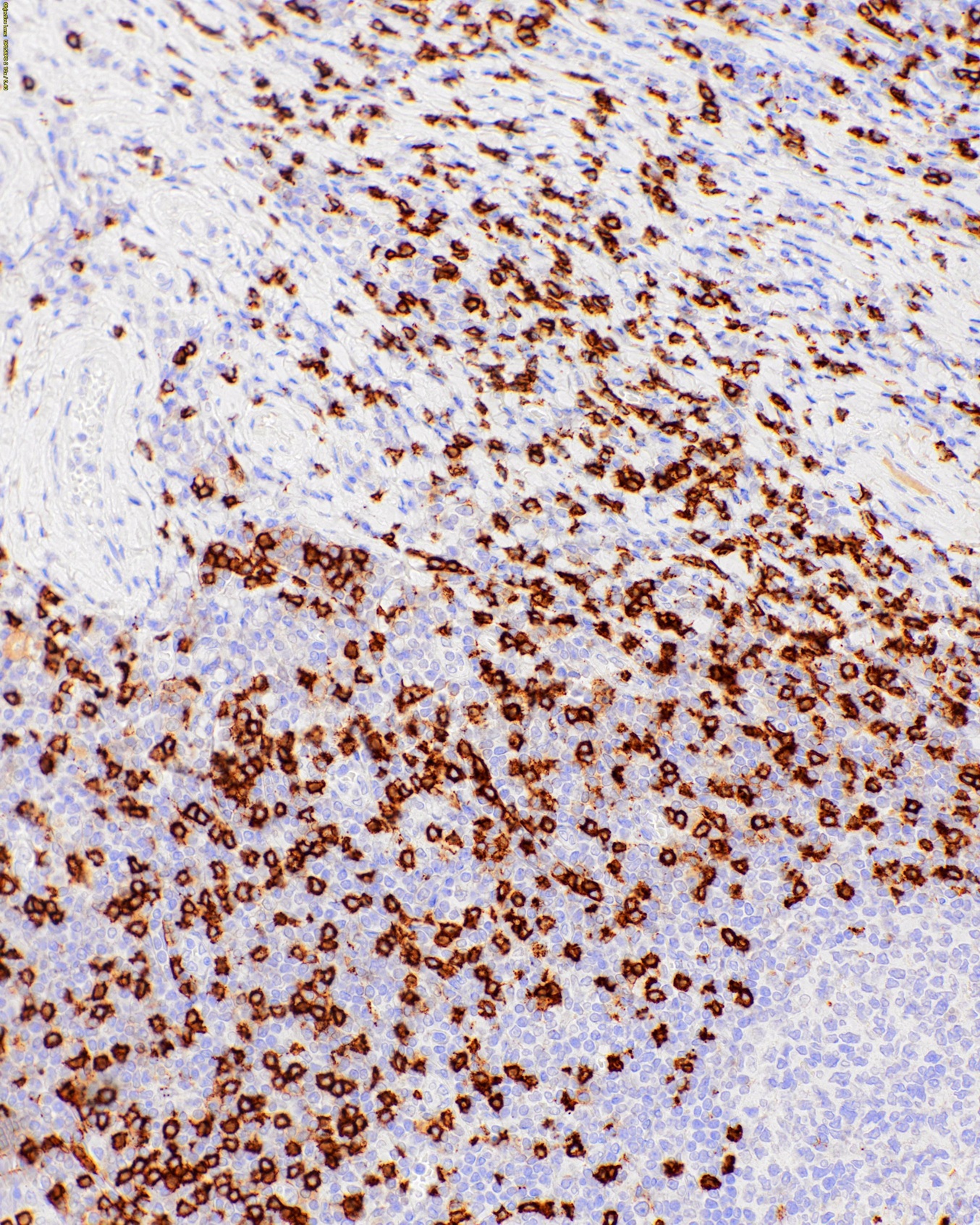 CD8 Mouse Monoclonal Antibody(ARM961)