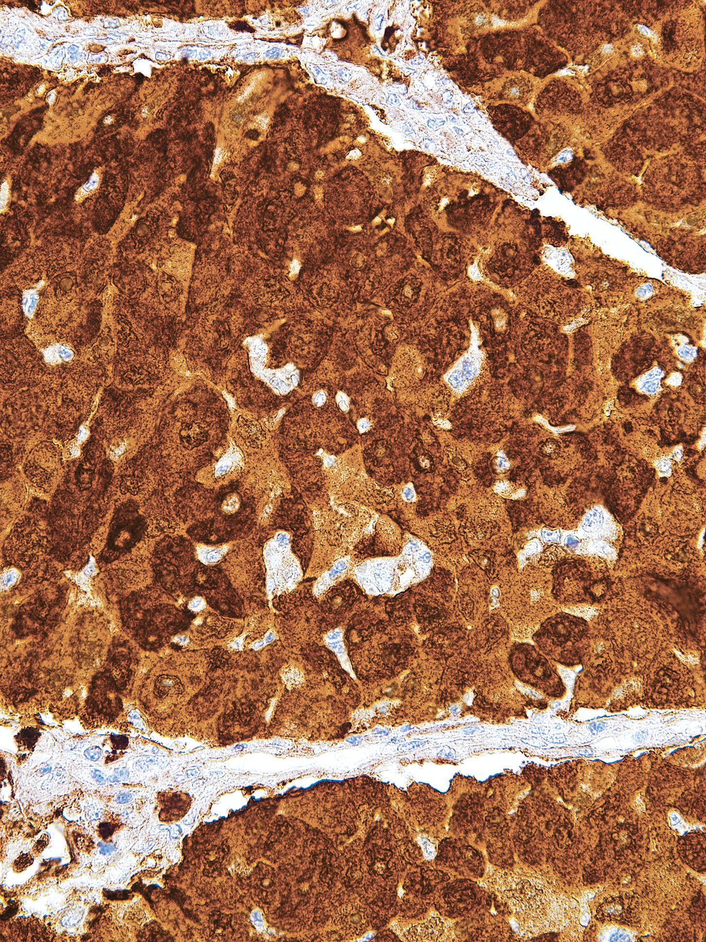 AKR1B10 Mouse Monoclonal Antibody(ARM920)