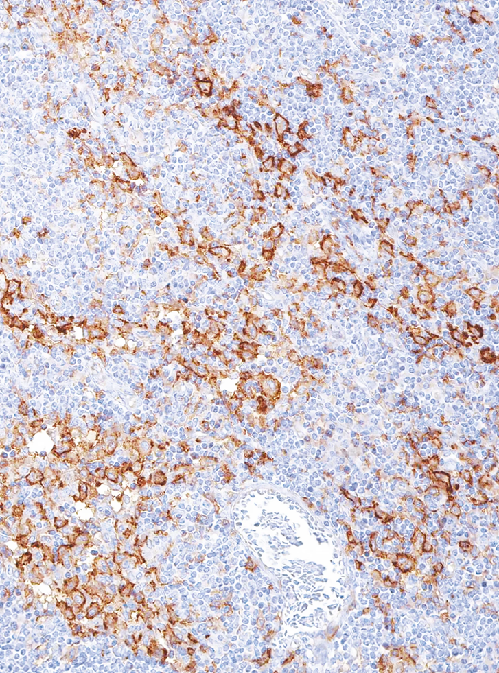 CD163 Mouse Monoclonal Antibody(ARM939)