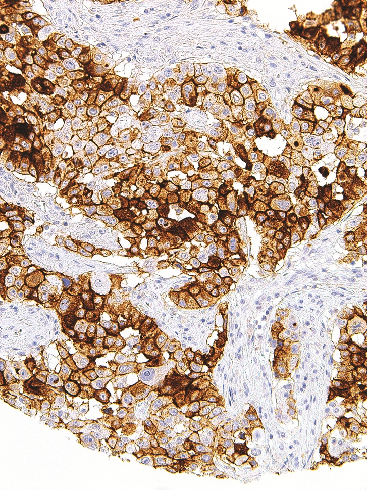CA-125 Mouse Monoclonal Antibody(ARM931)