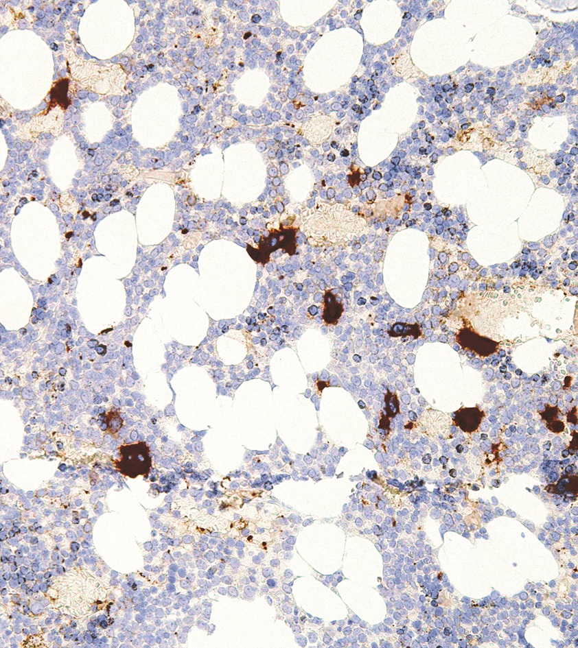 CD61 Mouse Monoclonal Antibody(ARM955)