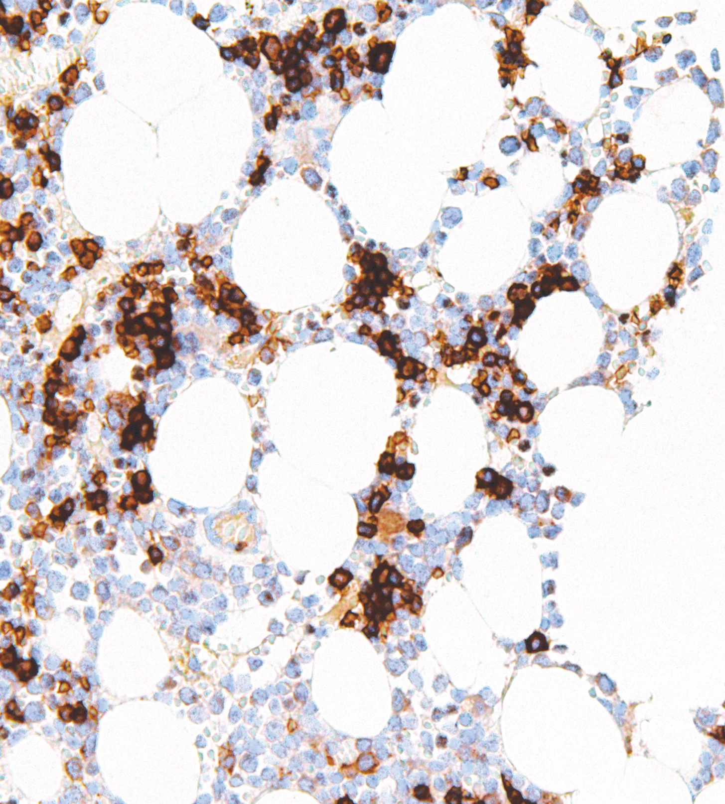 CD71 Mouse Monoclonal Antibody(ARM958)