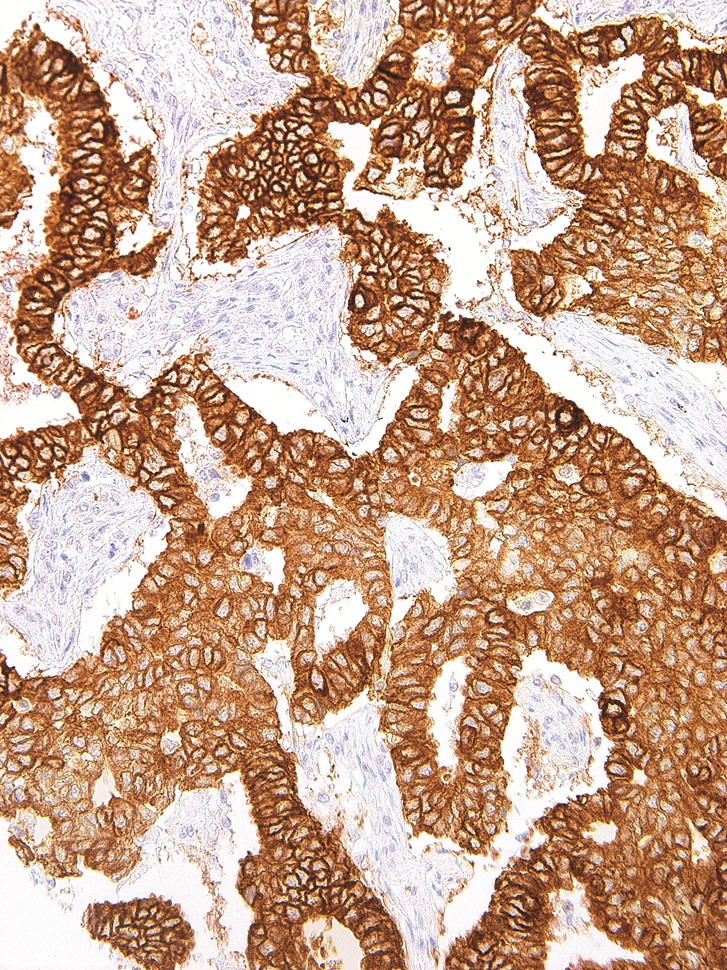 EGFR Mouse Monoclonal Antibody(ARM985)