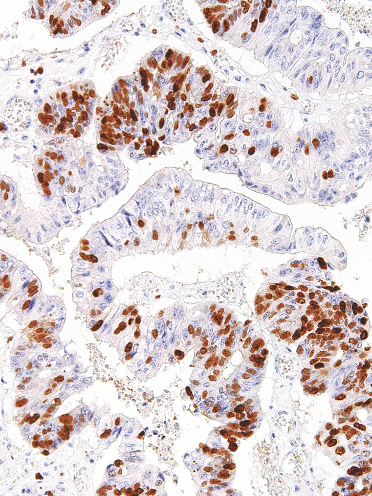 Survivin Mouse Monoclonal Antibody(ARM571)