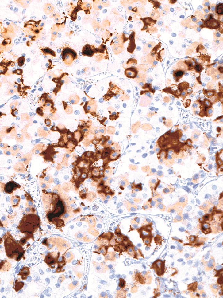 Prolactin Mouse Monoclonal Antibody(ARM556)