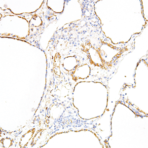 Tau Mouse Monoclonal Antibody(ARM573)