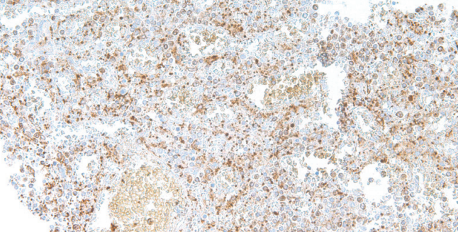 TGF&beta;1 Rabbit Monoclonal Antibody(ARM576)