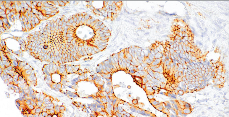 COX-2 Rabbit Monoclonal Antibody(ARM970)