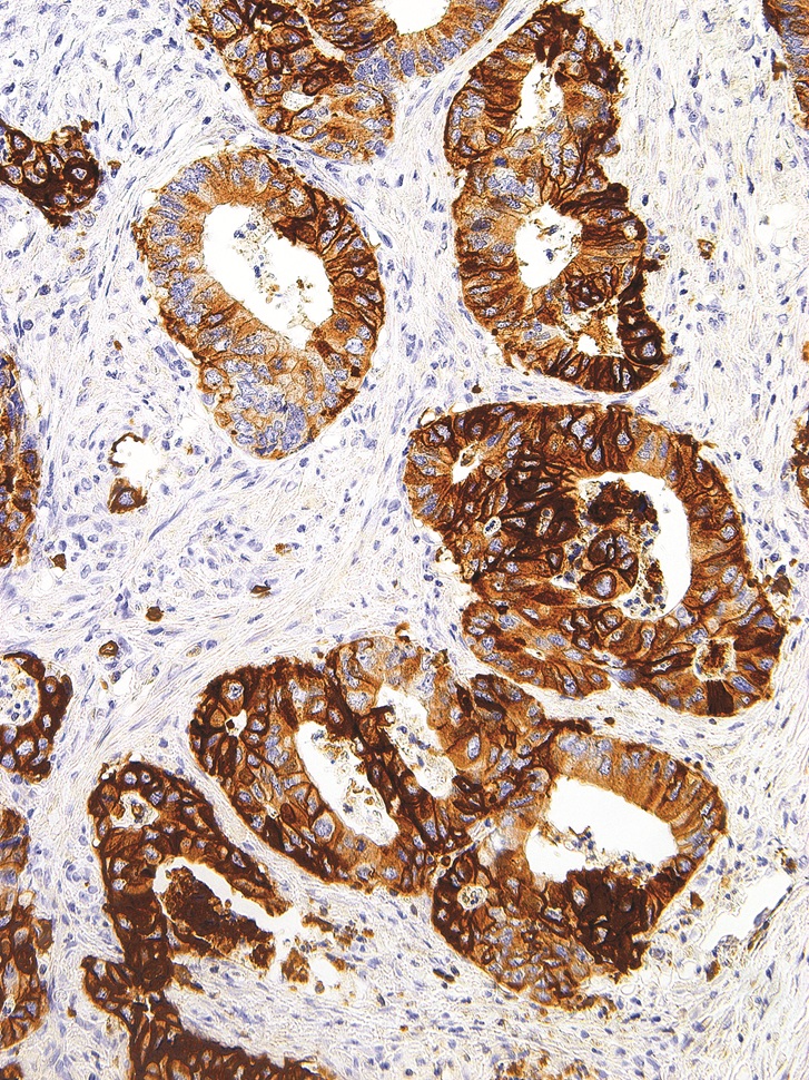 GLUT1 Mouse Monoclonal Antibody(ARM998)