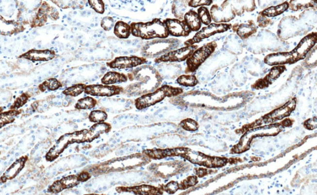 Ksp-cadherin Rabbit Monoclonal Antibody(ARM516)