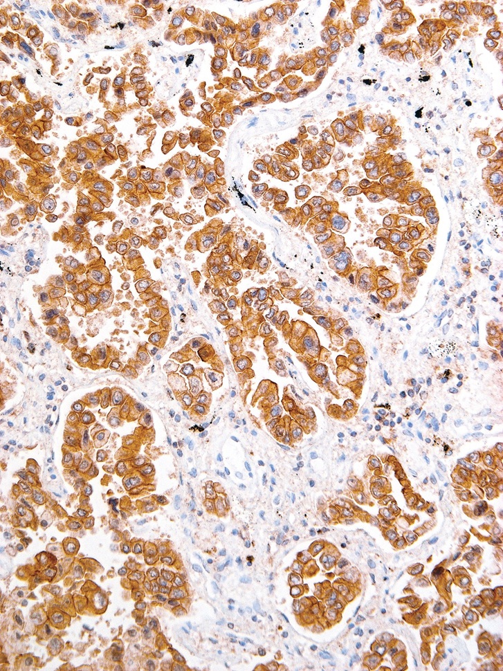 ROS1 Rabbit Monoclonal Antibody(ARM560)
