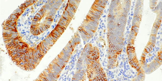 hENT1 Rabbit Monoclonal Antibody(ARM506)