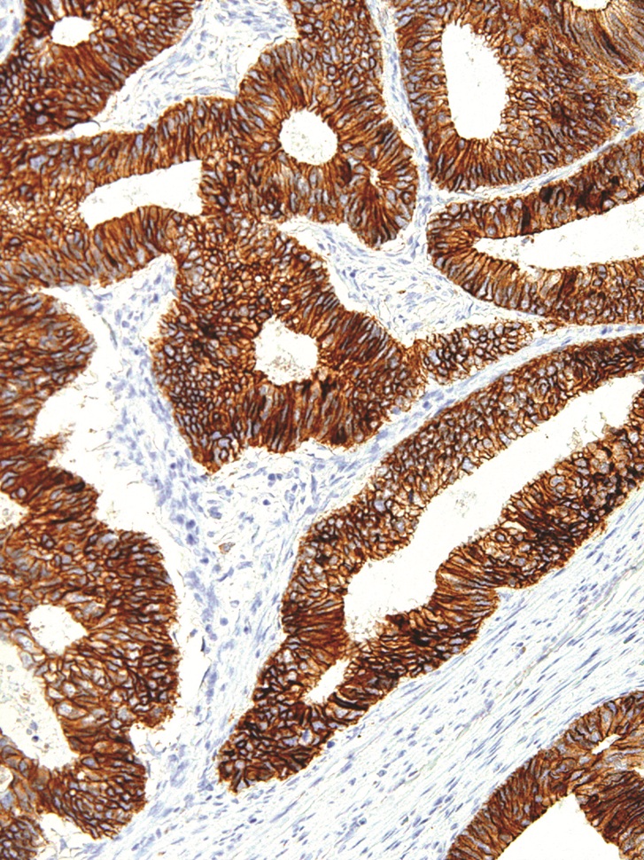 E-Cadherin Mouse Monoclonal Antibody(ARM984)