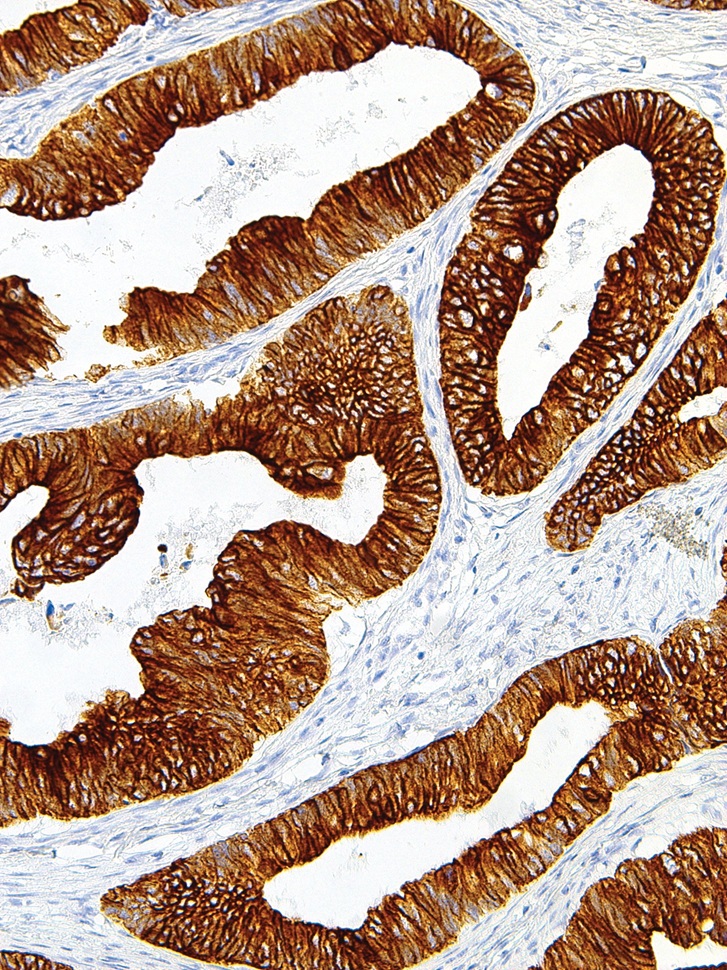 Cytokeratin 18 Mouse Monoclonal Antibody(ARM975)