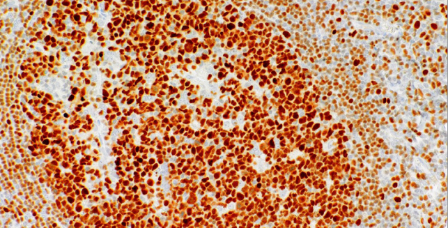 Oct-2 Mouse Monoclonal Antibody(ARM538)