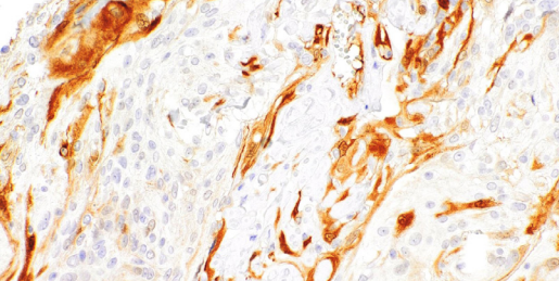 PGP 9.5 Mouse Monoclonal Antibody(ARM553)