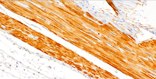 Smoothelin Mouse Monoclonal Antibody(ARM564)