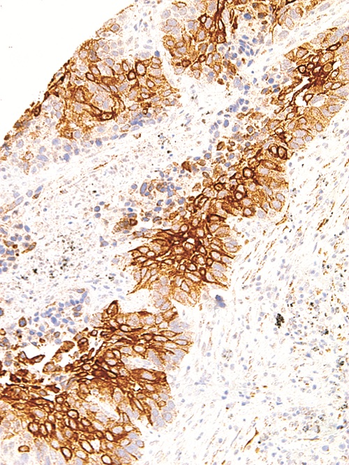 TAG-72 Mouse Monoclonal Antibody(ARM572)