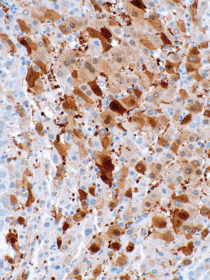 Glypican-3 Mouse Monoclonal Antibody(ARM500)