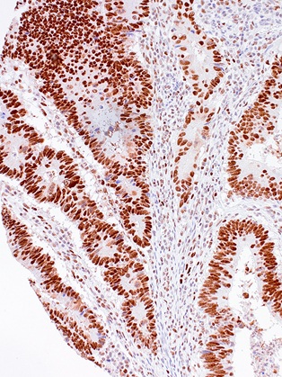 MSH2 Mouse Monoclonal Antibody(ARM527)