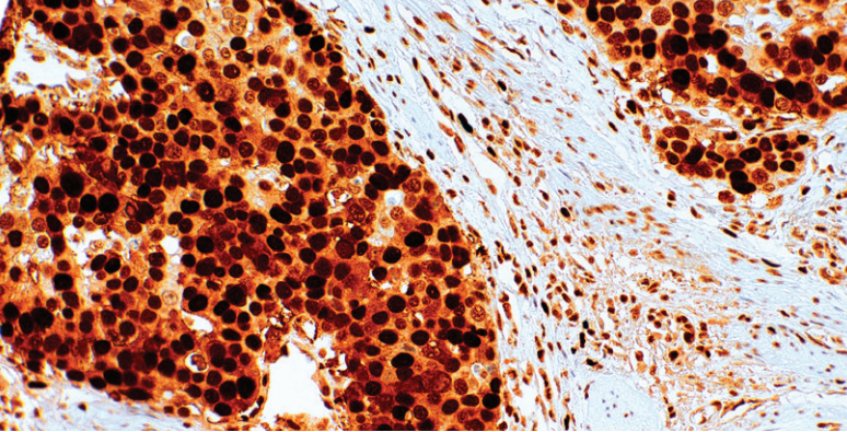 PCNA Mouse Monoclonal Antibody(ARM548)