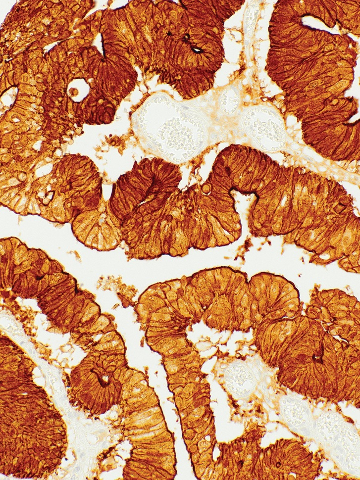 Villin Mouse Monoclonal Antibody(ARM584)