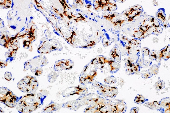 Factor XIIIa Rabbit Monoclonal Antibody(ARM989)