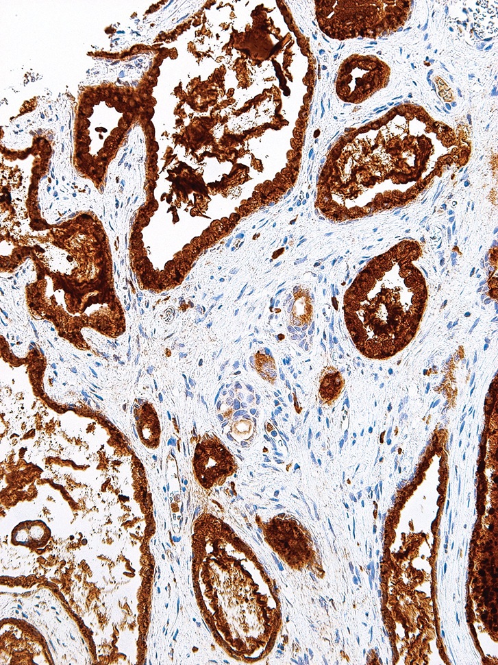 PSAP Mouse Monoclonal Antibody(ARM557)