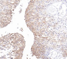 Uroplakin 1b(UPK1B) Rabbit Monoclonal Antibody(ARB576)