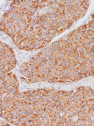 N-cadherin Rabbit Monoclonal Antibody(ARM535)