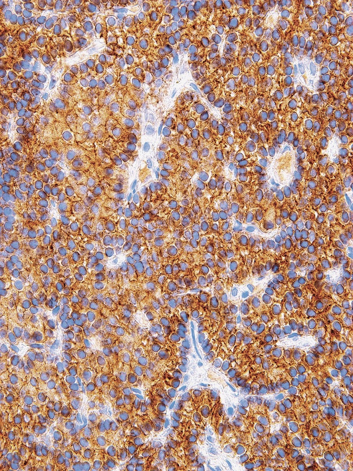 Parathyroid Hormone (PTH) Mouse Monoclonal Antibody(ARM547)