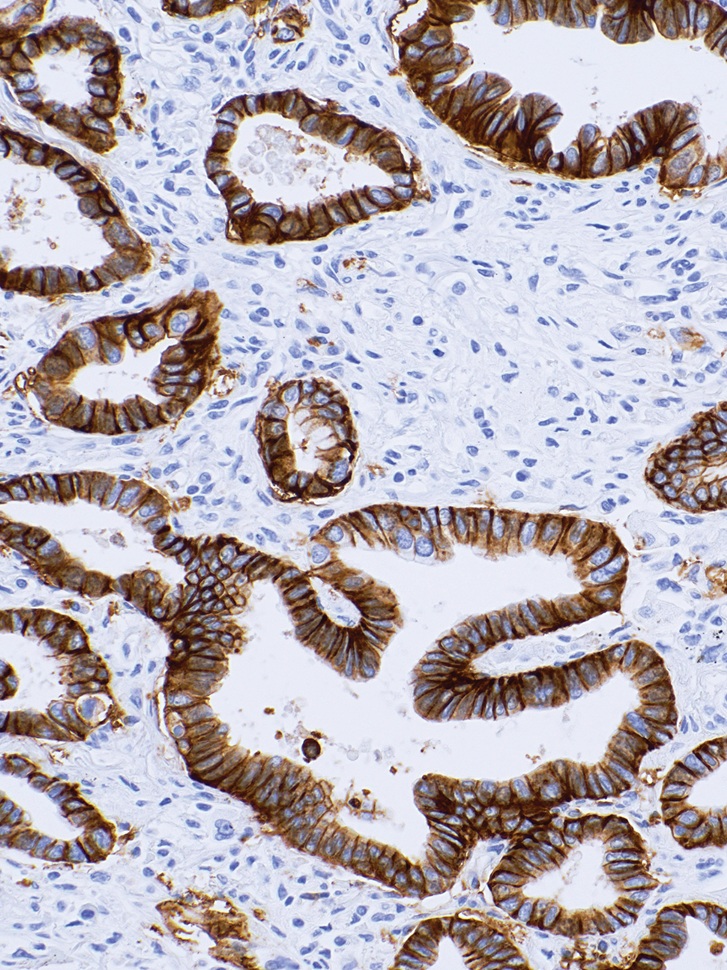 PD-L1-TEC Rabbit Monoclonal Antibody(ARM551)