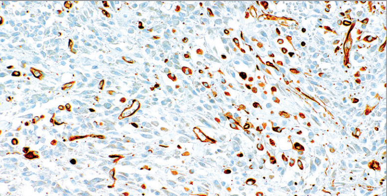 Nestin Rabbit Monoclonal Antibody(ARM536)
