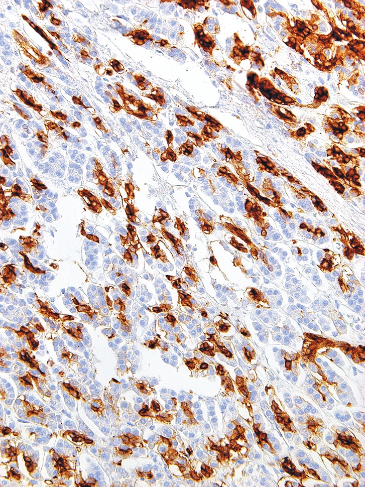SPNS2 Mouse Monoclonal Antibody(ARM568)