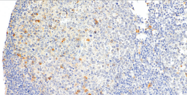 OX40 Rabbit Monoclonal Antibody(ARM540)