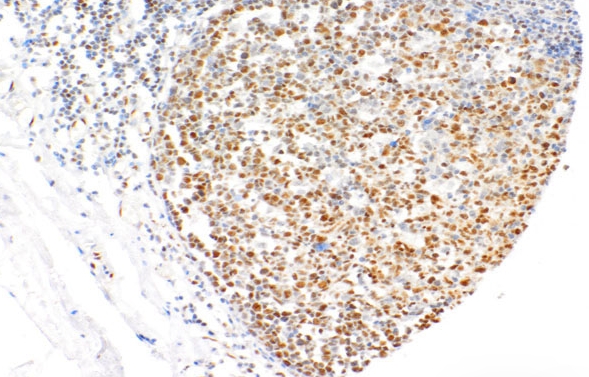 LMO2 Rabbit Monoclonal Antibody(ARM519)