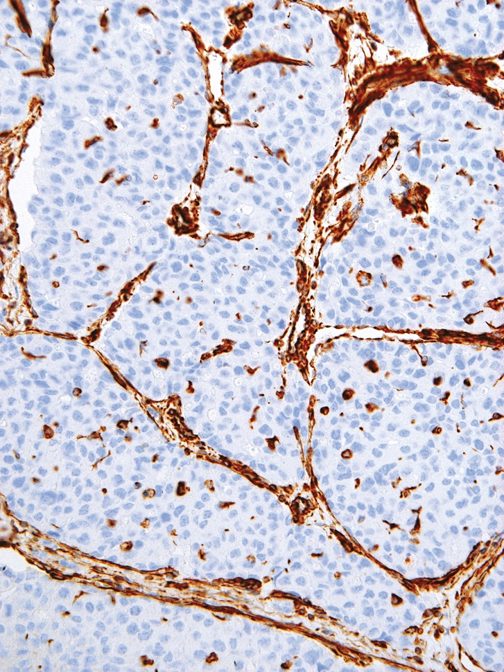 Vimentin Mouse Monoclonal Antibody(ARM585)
