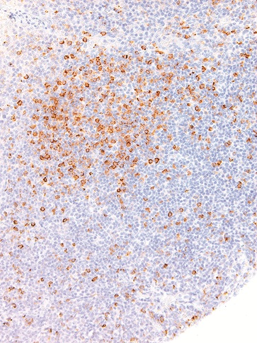 Hairy Cell Leukemia Mouse Monoclonal Antibody(ARM503)