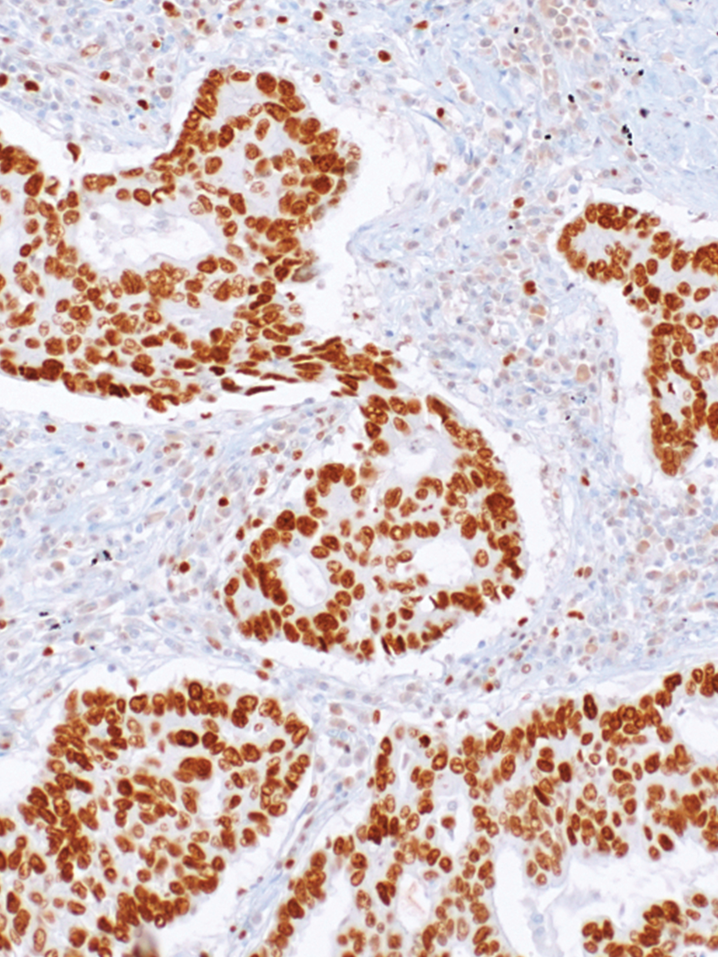EZH2 Rabbit Monoclonal Antibody(ARM988)