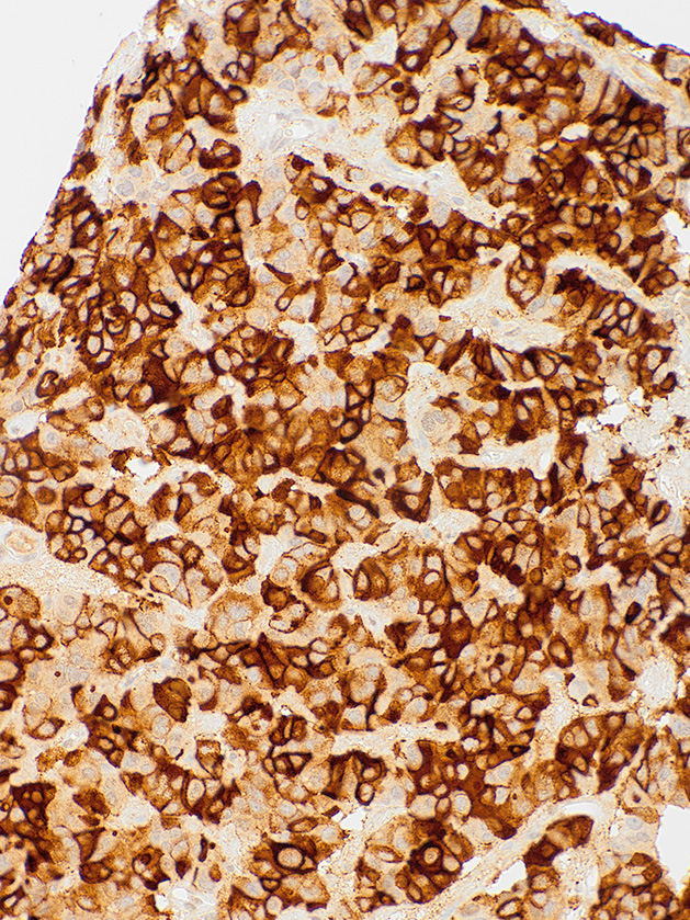 TSH Mouse Monoclonal Antibody(ARM583)