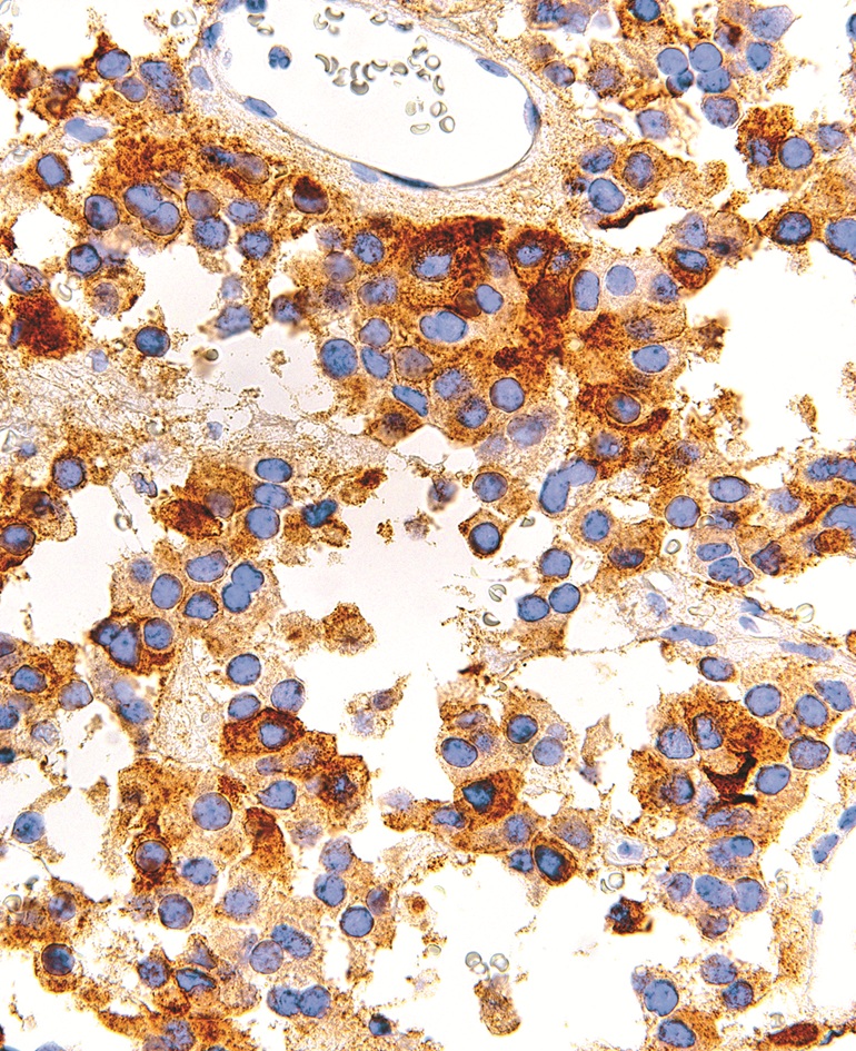 FSH Mouse Monoclonal Antibody(ARM993)