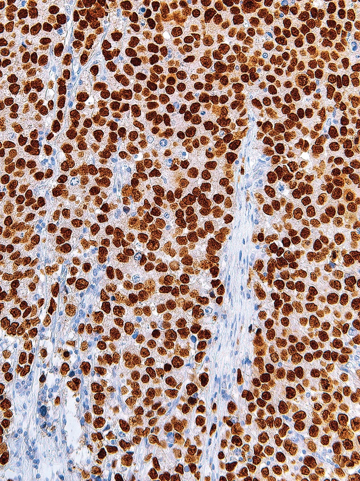 SALL4 Mouse Monoclonal Antibody(ARM563)